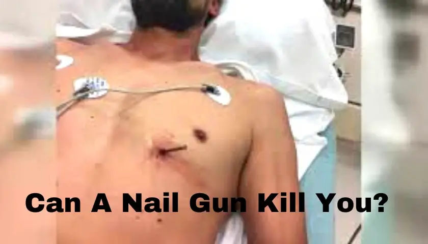 can a nail gun kill you